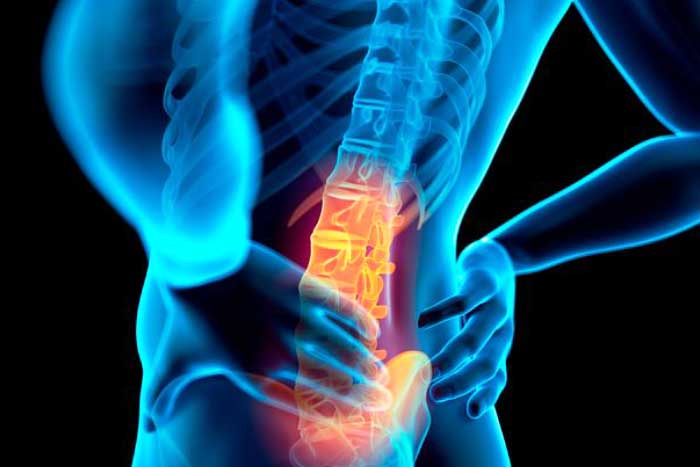 tratamentul osteofitelor coloanei toracice durere neplăcută de genunchi