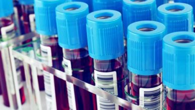 Boala von Willebrand