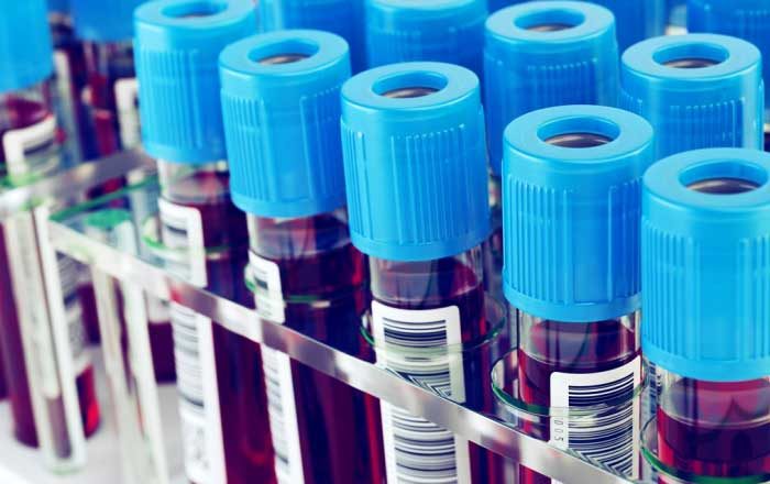 Boala von Willebrand