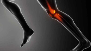 gonartroza artroza genunchiului