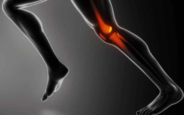 artroza acută a genunchiului)