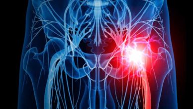 coxartroza simptome tratament