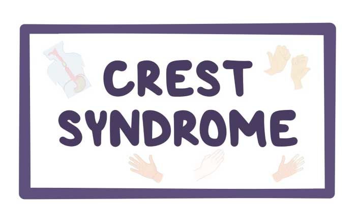Sindromul Crest