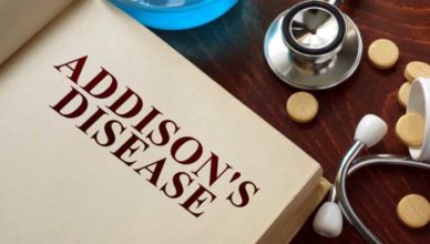 boala addison tratament simptome cauze diagnostic