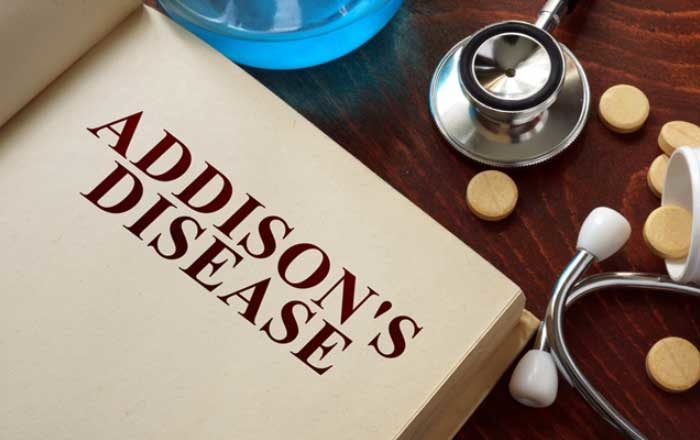 boala addison tratament simptome cauze diagnostic