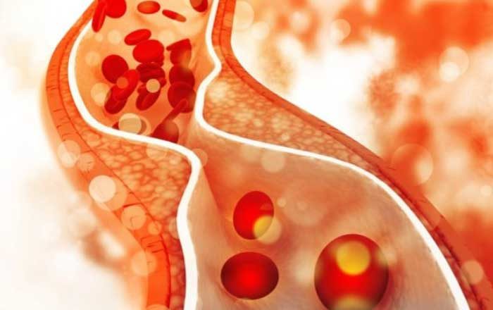 Bolile arterelor şi ale venelor